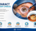 Cataract Surgery (PHACO)