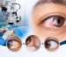 Pterygium Surgery